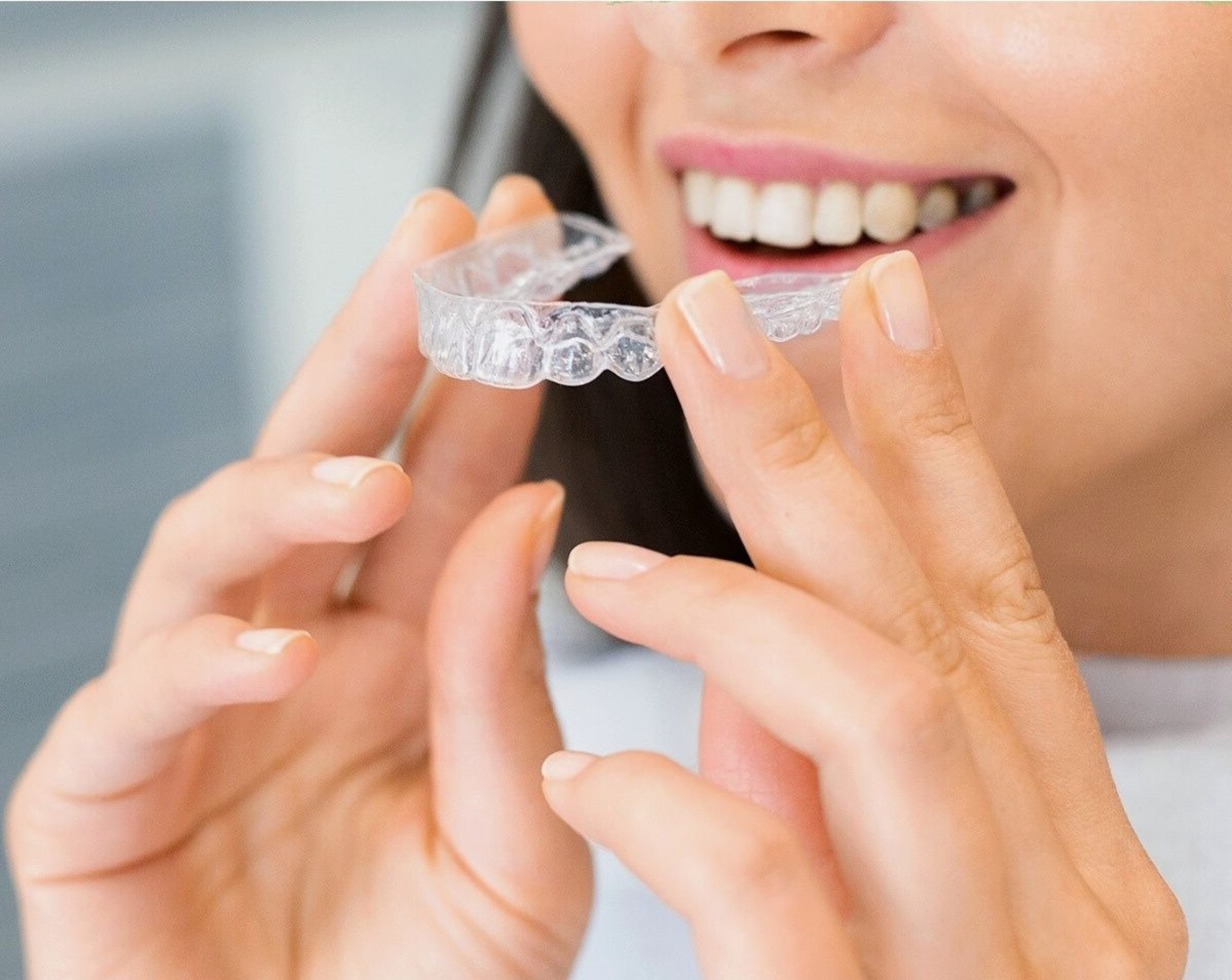A Detailed Comparison Between Spark Clear Aligners and Invisalign