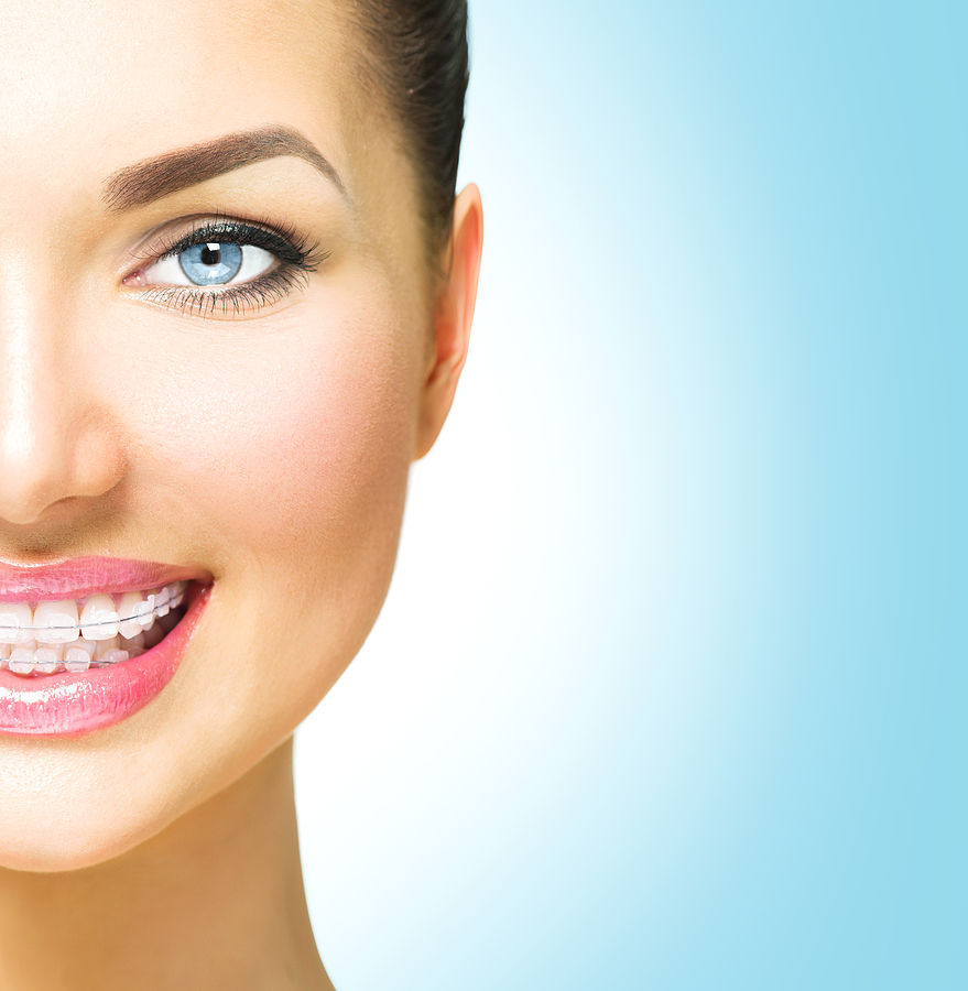 A Discreet Path to a Straighter Smile: Ceramic Braces in The Woodlands, TX