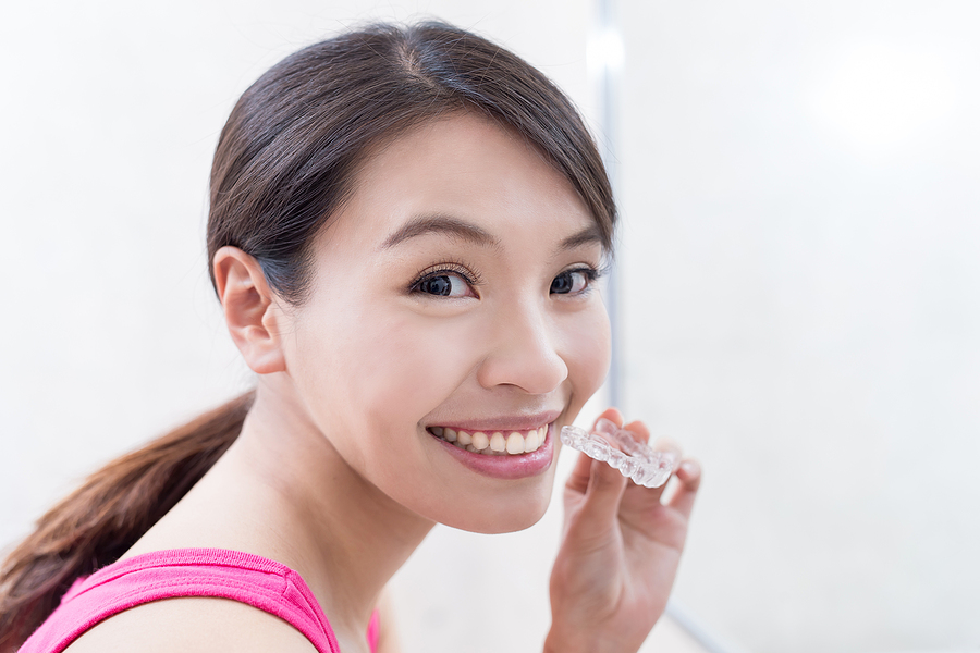 Clear Aligners for Busy Professionals: Discreet and Convenient