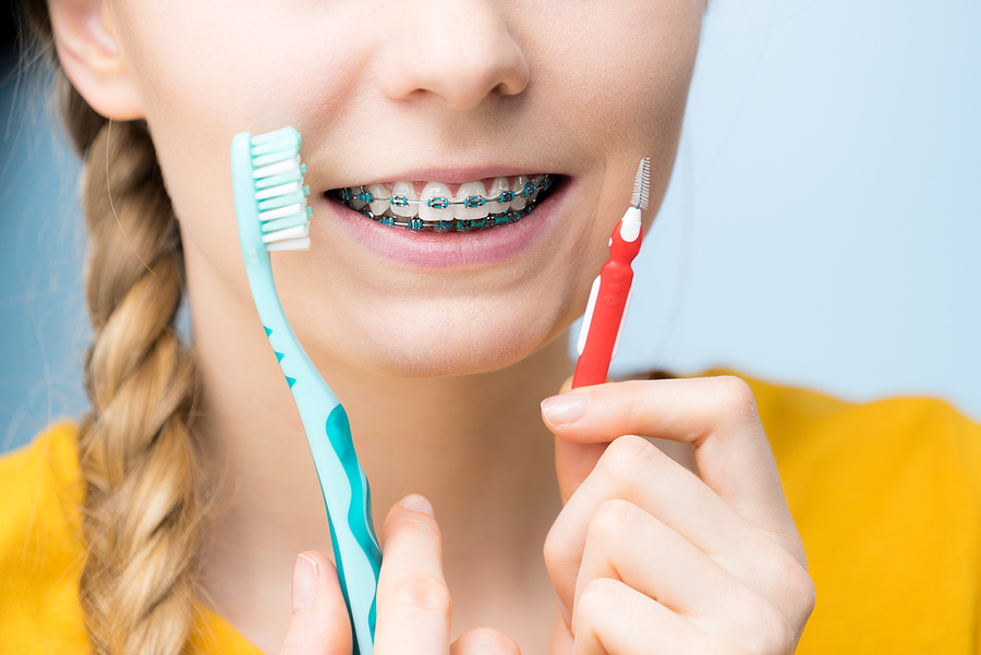 Essential Tips for Maintaining Oral Hygiene with Braces