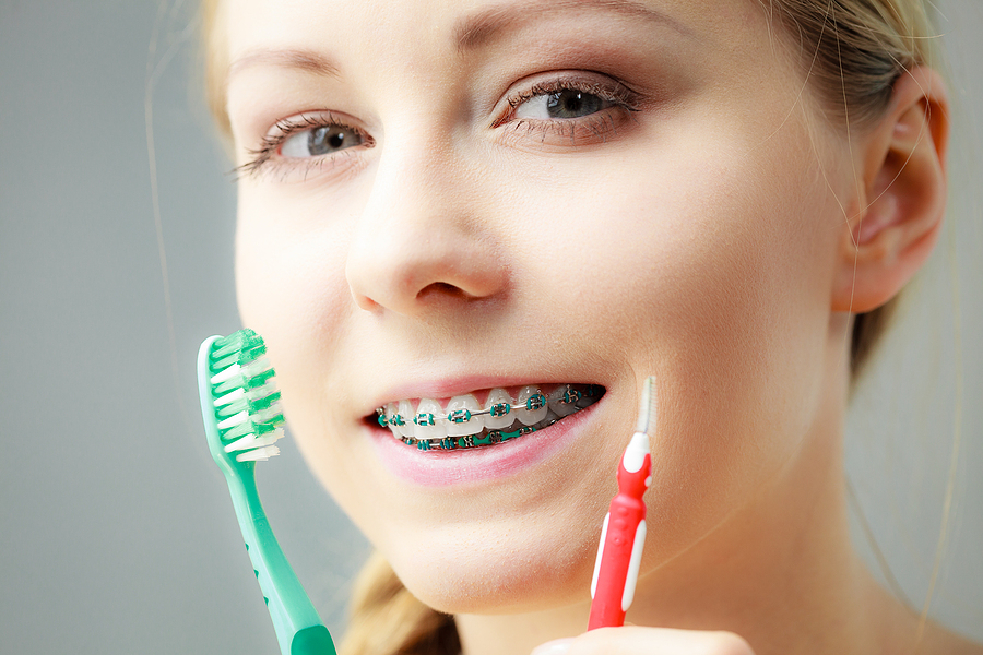 What Happens If You Don’t Clean Your Teeth Properly During Ortho Treatment?