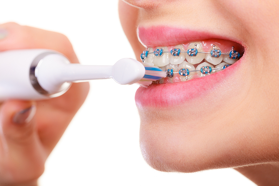 The Science Behind Tooth Movement: How Braces Really Work